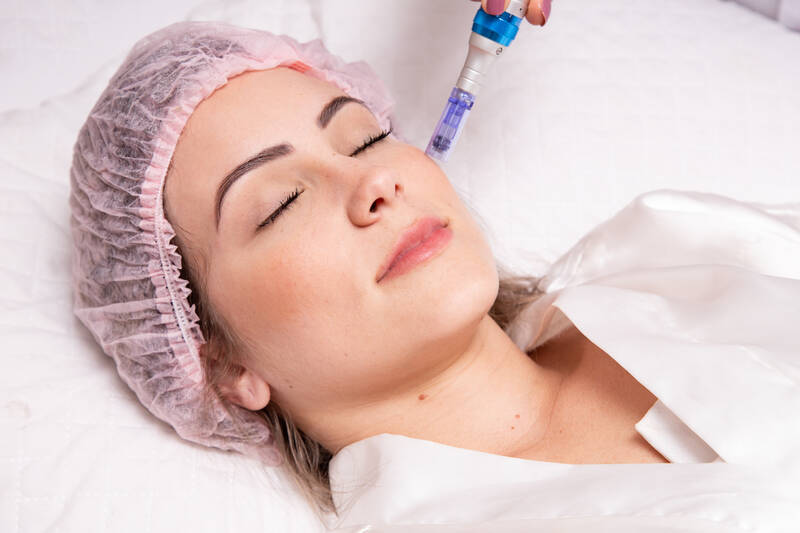 medizinisches-microneedling-effektive-hautverjuengung-und-regeneration-s154277